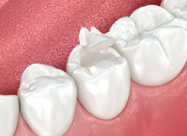 Best Dental Exams and Cleanings  in Lanark, IL